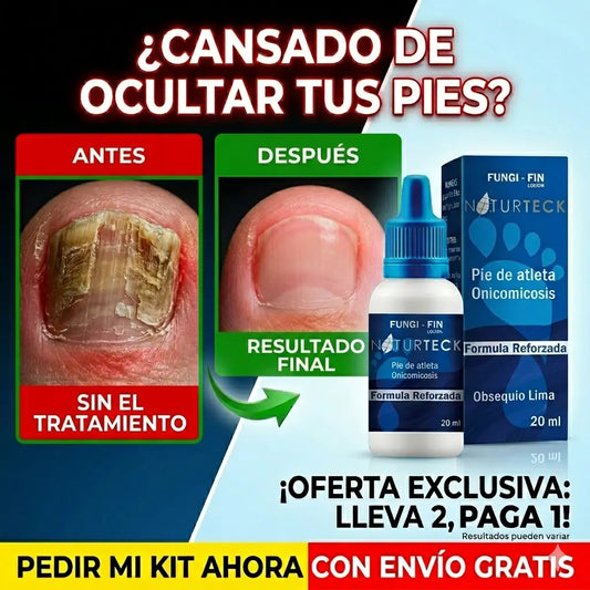 2x1 - Fungi-Fin: Mejora el aspecto de tus Uñas - Adios Hongos